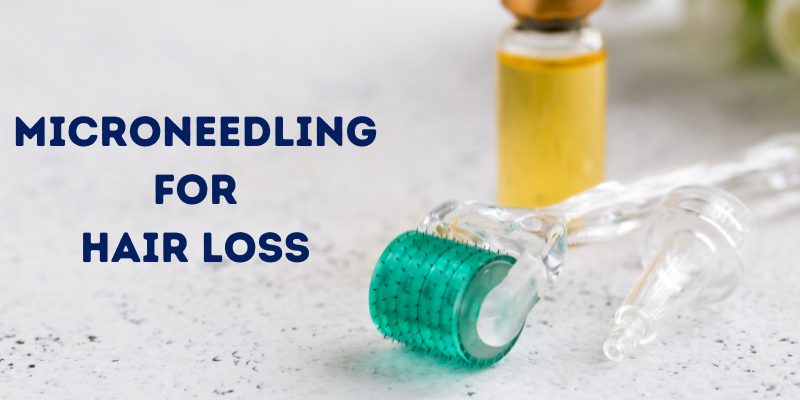 Microneedling for hair loss - Does it work?