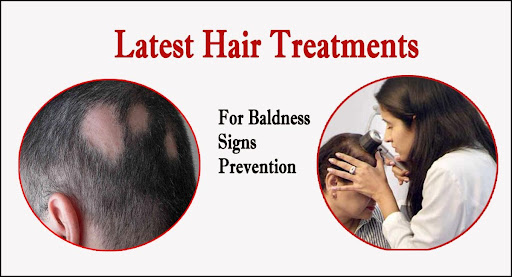 Latest Hair Treatments for Baldness, Signs, and Prevention